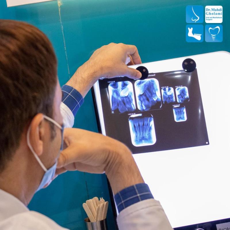 جراحی زیبایی فک و صورت