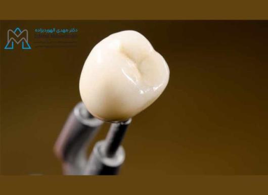 پروتز های دندانی در ارومیه